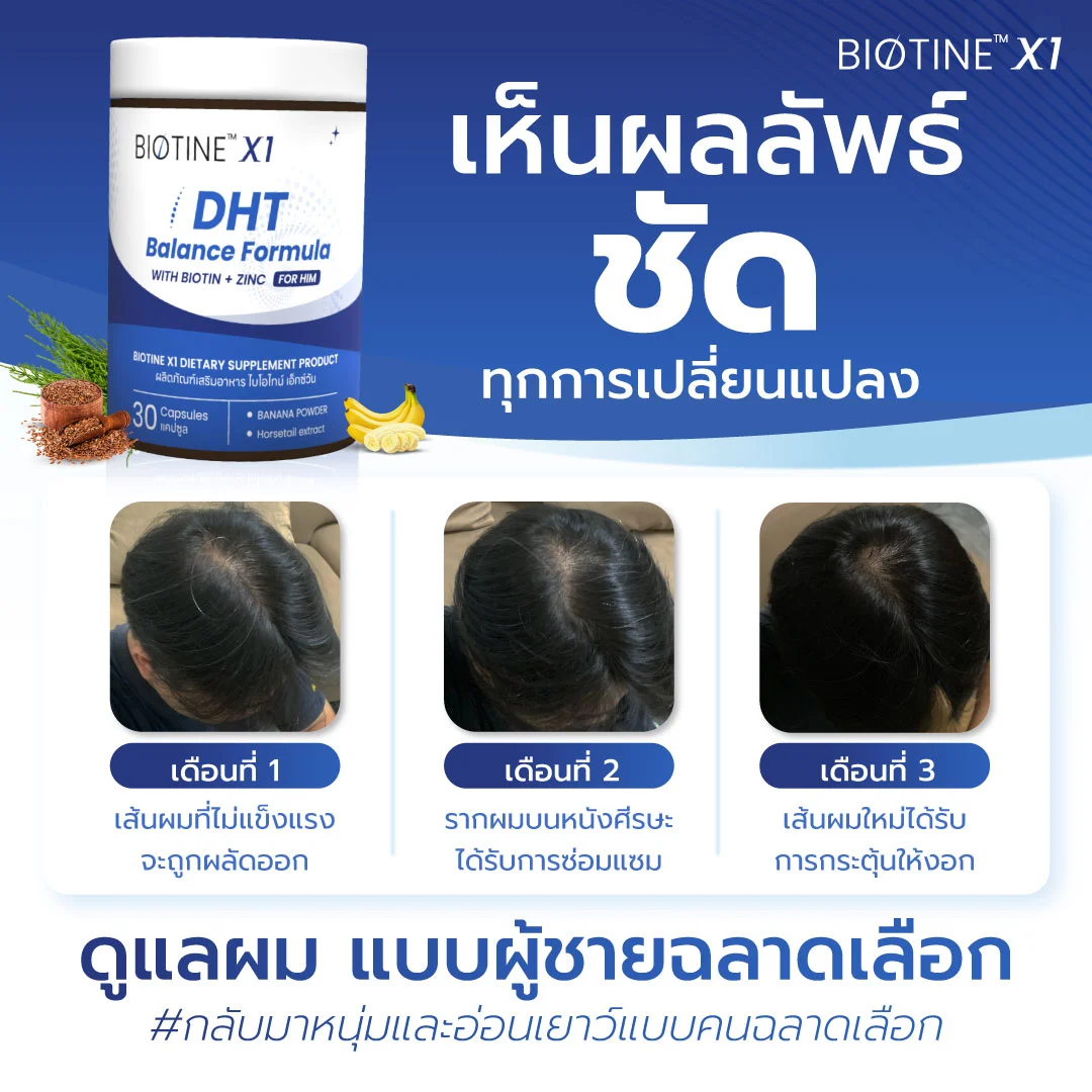 20240709 kat ภาพเปิดตัวสินค้า biotinex1 สำหรับ marketplace เห็นผลลัพธ์ชัด