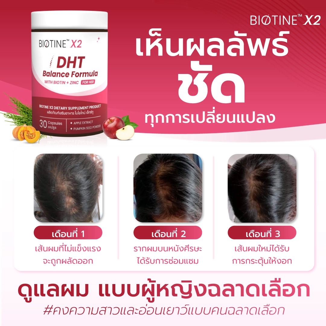 20240709 kat ภาพเปิดตัวสินค้า biotinex2 สำหรับ marketplace เห็นผลลัพธ์ชัด